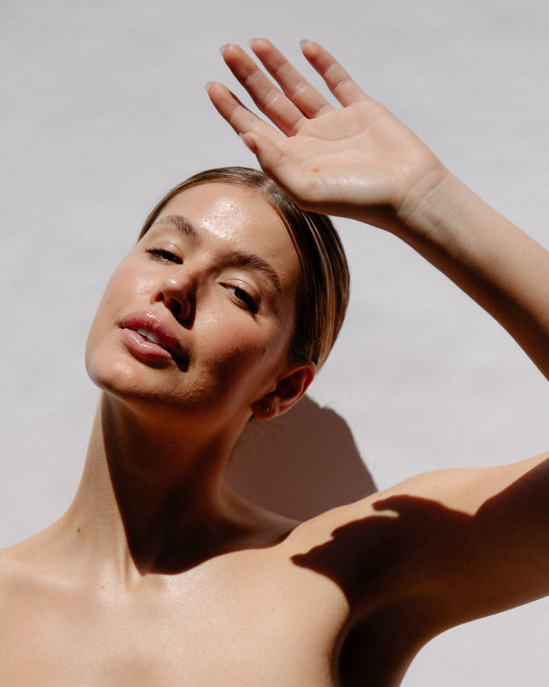 Skin Series: About Sunburn