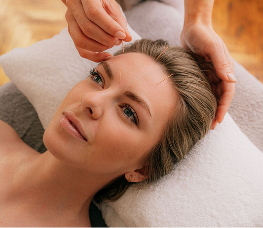Facial Acupuncture, Explained