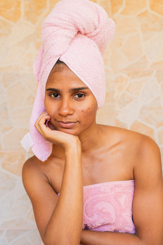 Adult vs Teenage Acne