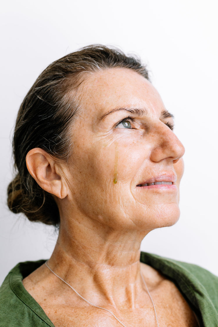Pigmentation